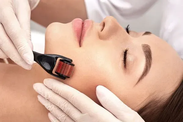 benefits of derma roller
