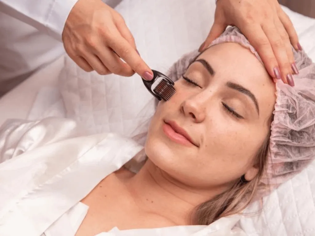 microneedling treatment process