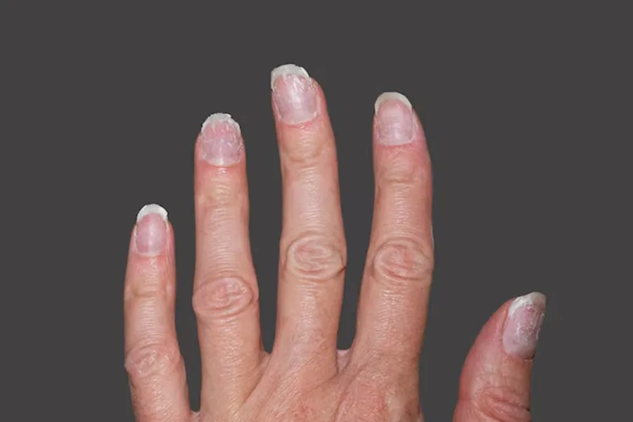 rice water restores nail shine