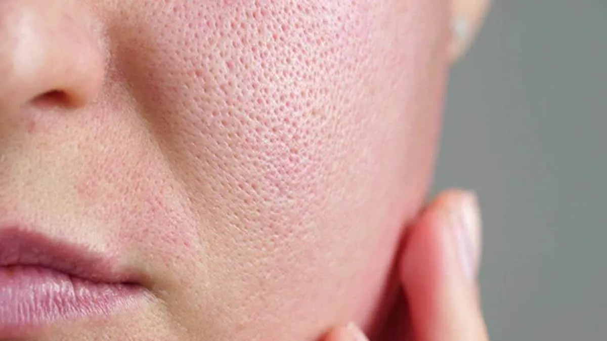 Multani Mitti and Rose Water Face Pack for Pore Tightening