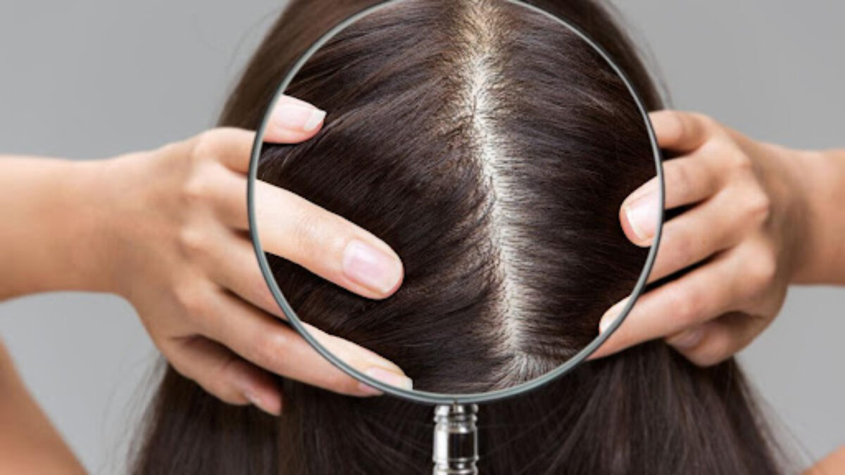 hair care routine to prevent dandruff and hair loss