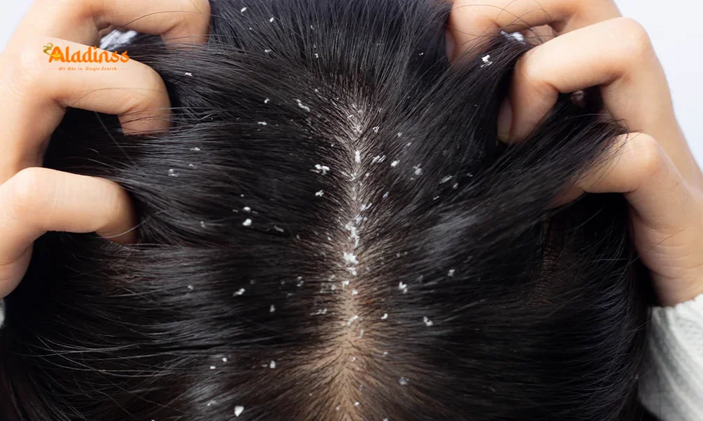 Hair Care to Stop Dandruff & Loss
