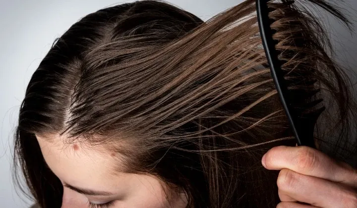 Oily Dandruff Fixes