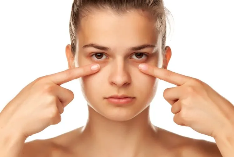 how to remove dark circles naturally