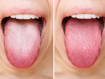 Tongue showing various colors and coatings
