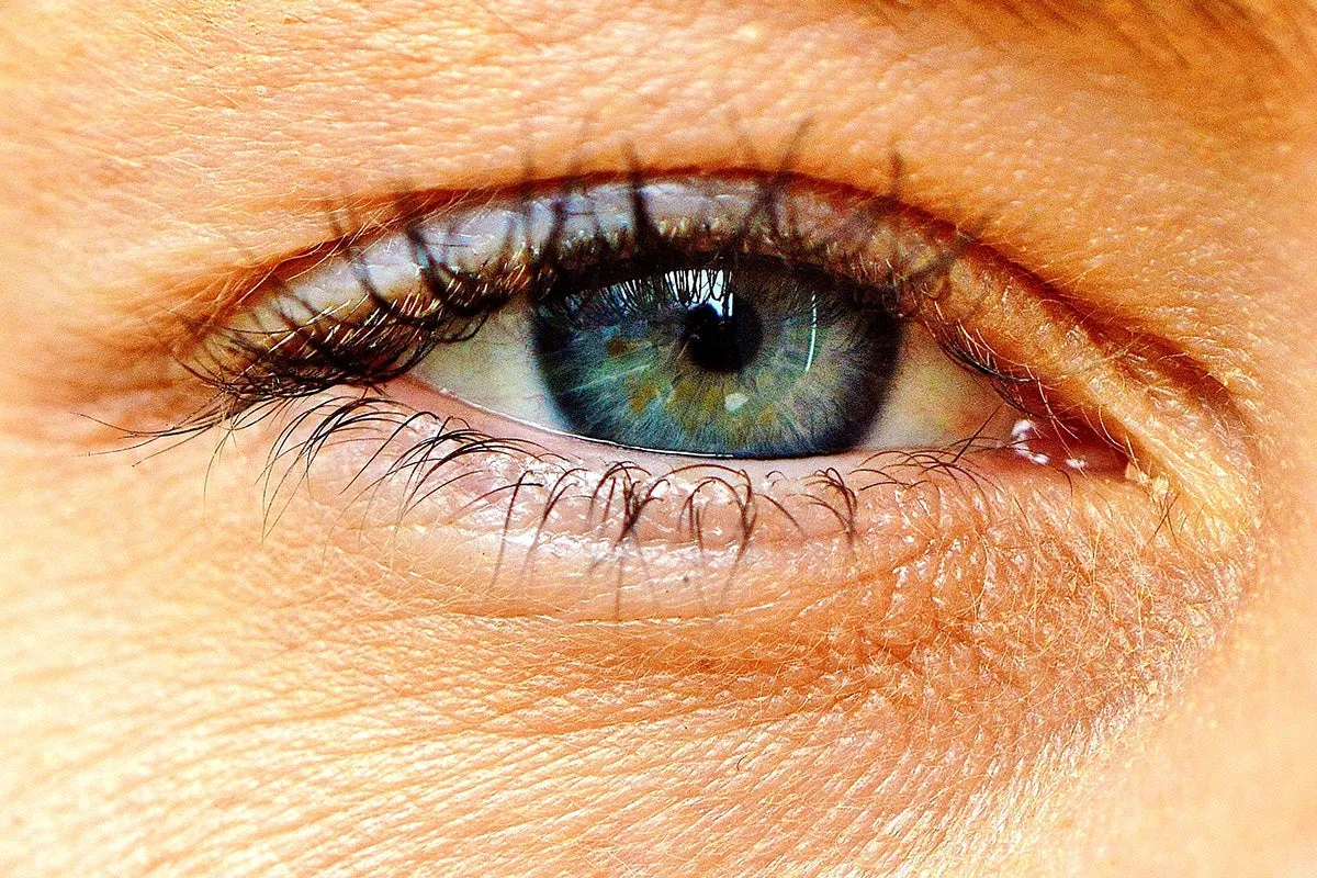 Eye symptoms indicating kidney problems like swollen or red eyes