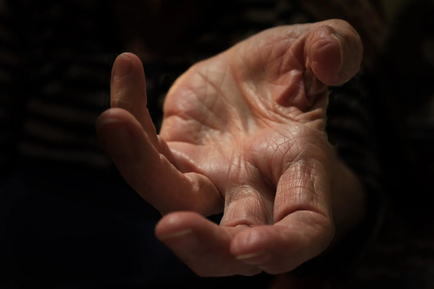 Palm skin structure explaining no hair growth