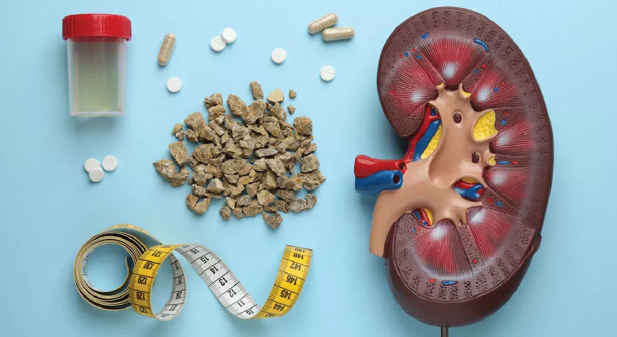 Kidney health and diet
