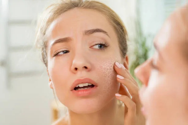 Foods Causing Facial Swelling