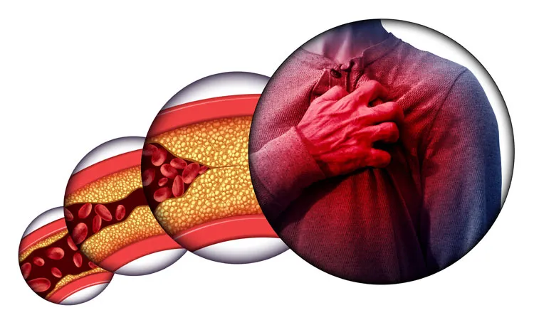 Family History and Cholesterol Risk
