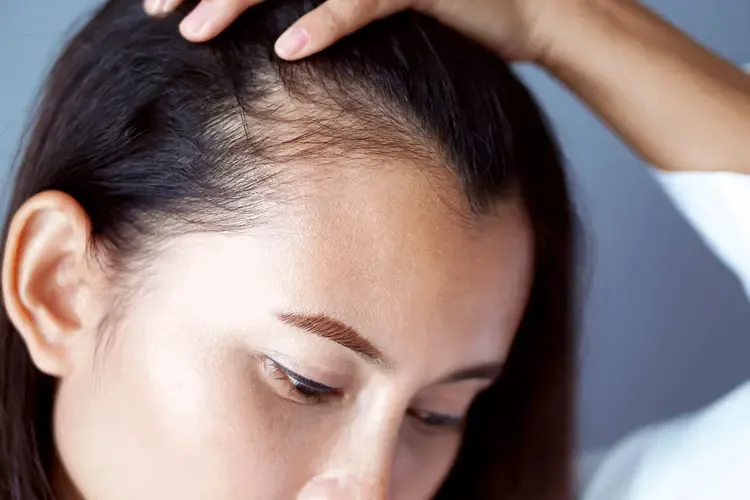 Hair Loss Age Differences Men vs Women