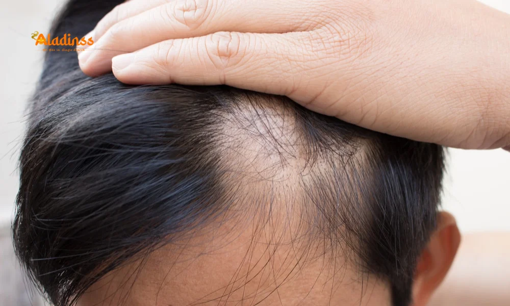 Baldness Symptoms in Men vs. Women: How to Recognize and Prevent Hair Loss
