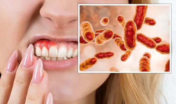 oral health stroke risk gum disease bacteria artery inflammation