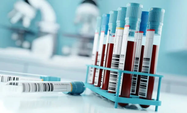 Blood Test Report Tirunelveli