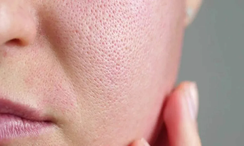 Multani Mitti and Rose Water Face Pack for Pore Tightening