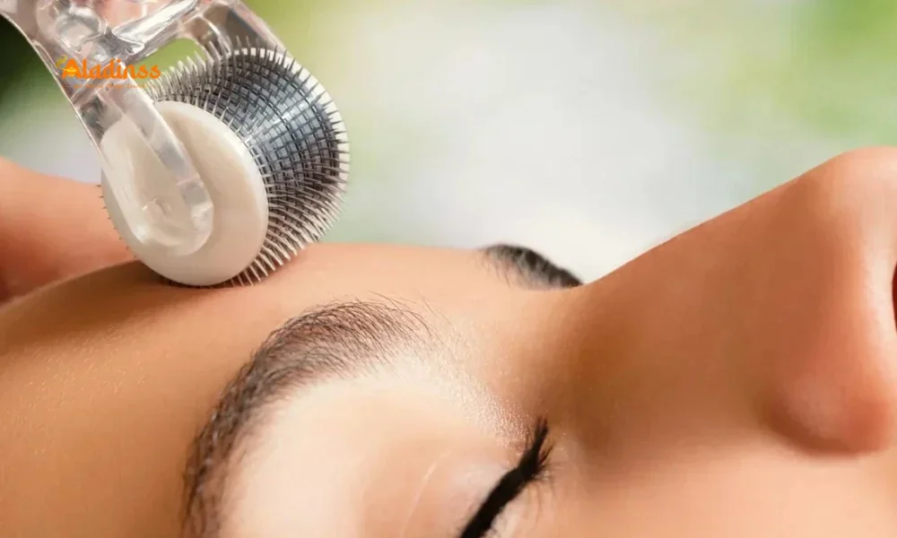 Power of Microneedling: Derma Roller Benefits