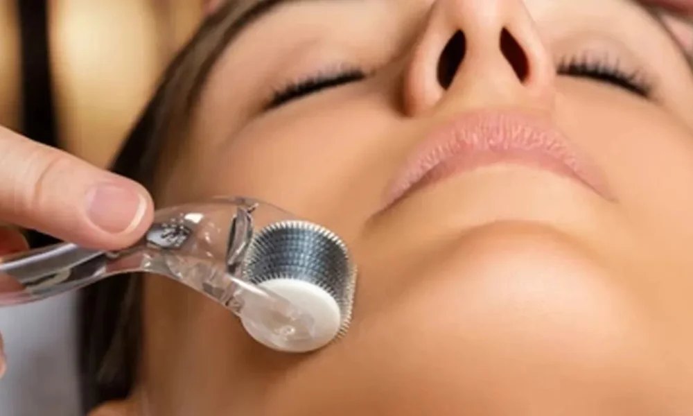 derma roller therapy process