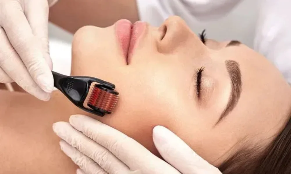 benefits of derma roller