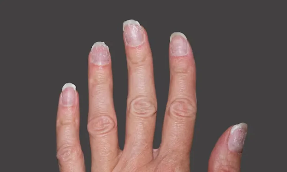rice water restores nail shine