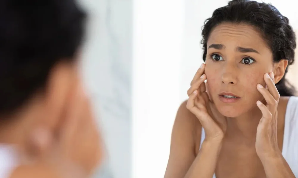 Foods Causing Facial Swelling