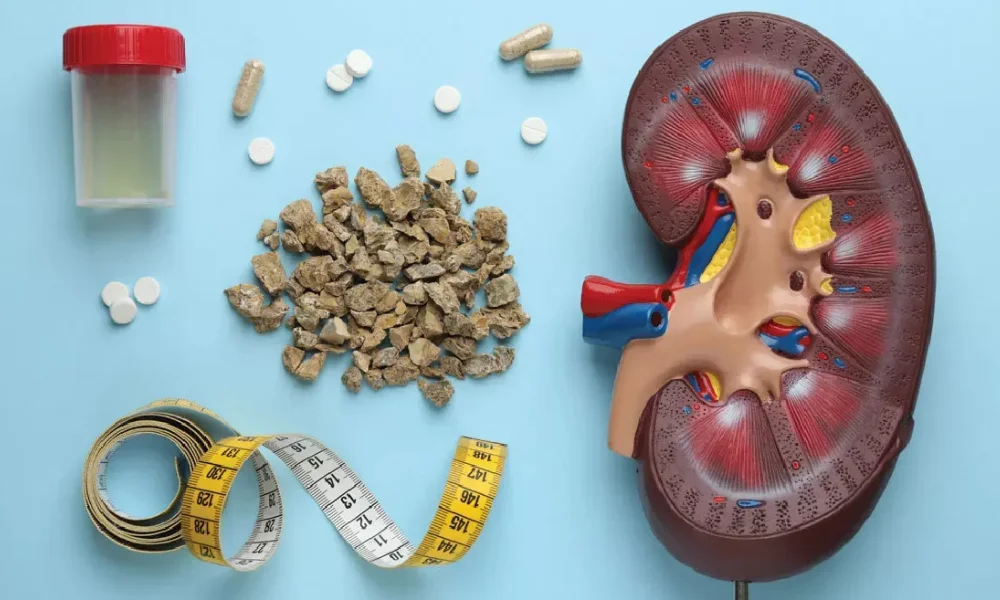 Kidney health and diet