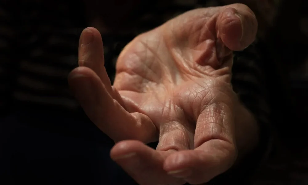 Palm skin structure explaining no hair growth