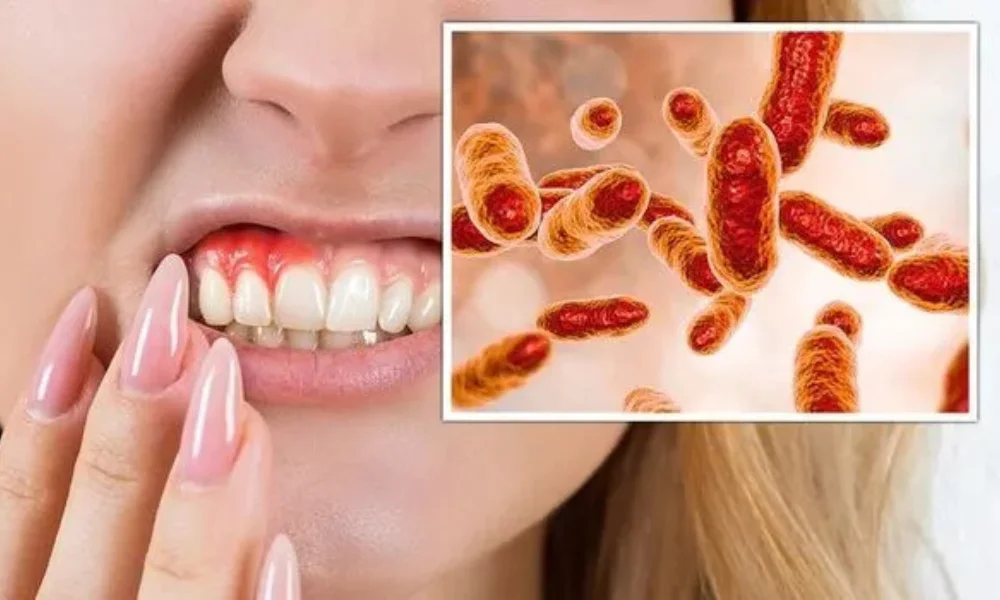 Warning! Gum Disease Can Trigger Stroke – Save Your Brain Now