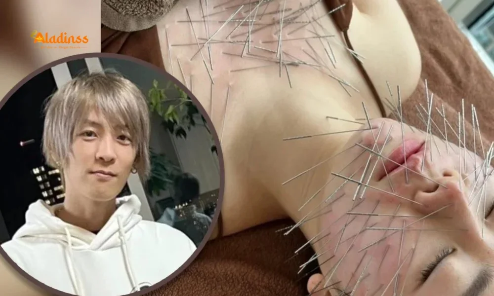 Acupuncture Craze in Japan: Human Porcupine Trend Goes Viral