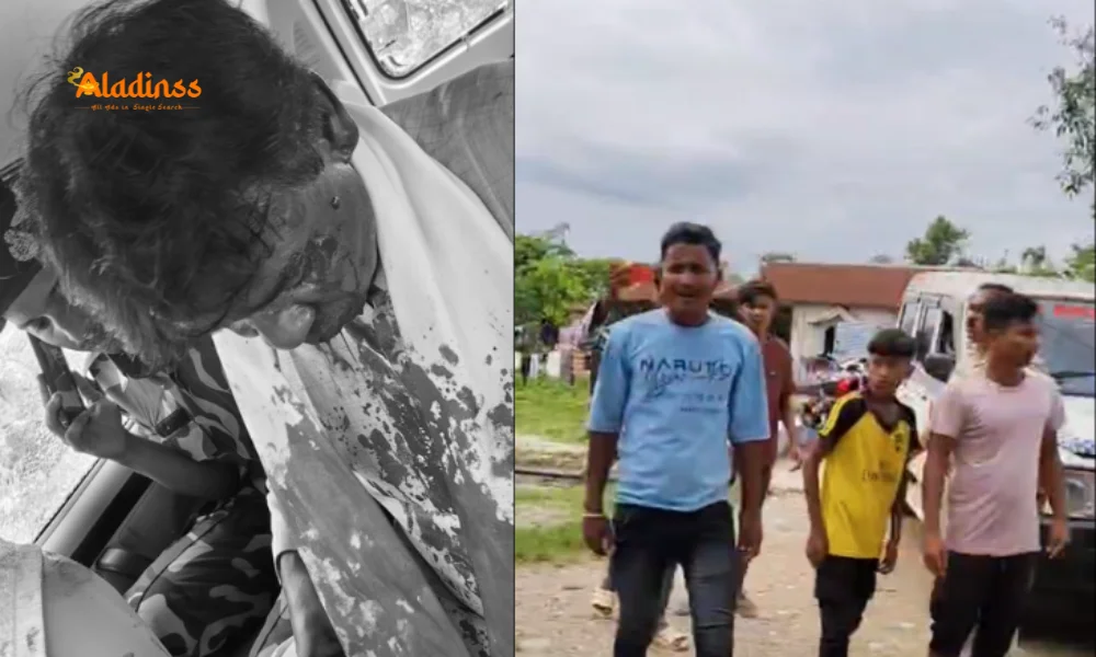 Khagen Murmu Attack: Eye Fracture in Bengal Flood Assault