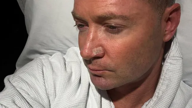 Michael Clarke Skin Cancer Diagnosis 2025