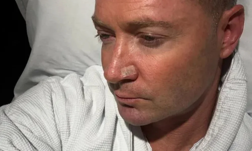 Michael Clarke Skin Cancer Diagnosis 2025
