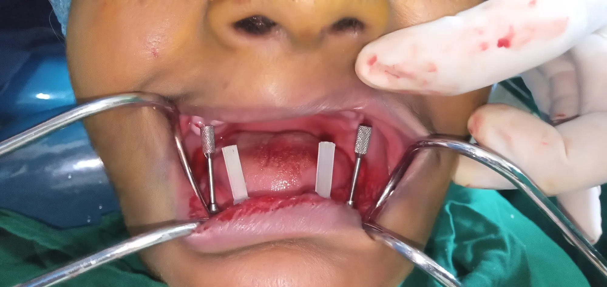 Image of: Kesavan Dental Clinic in K Pudur Madurai