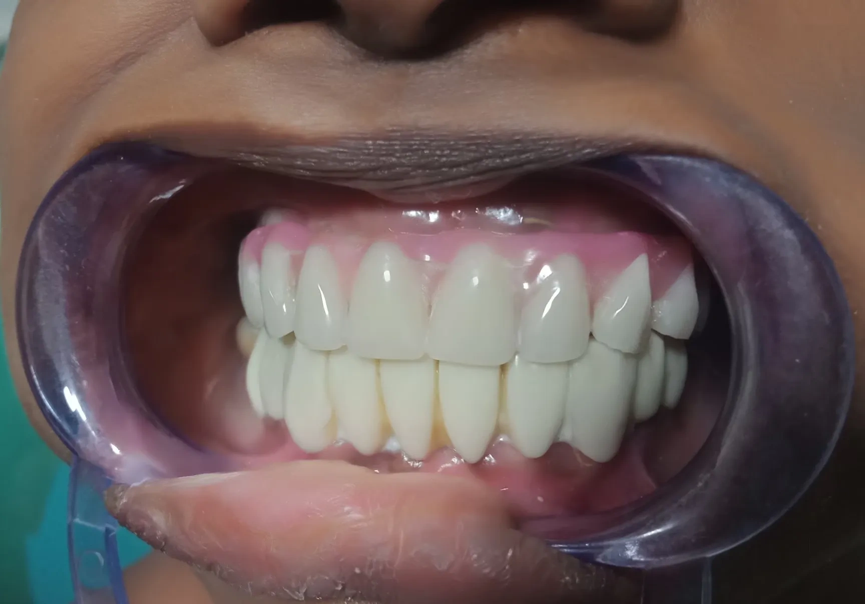 Image of: Kesavan Dental Clinic in K Pudur Madurai 3