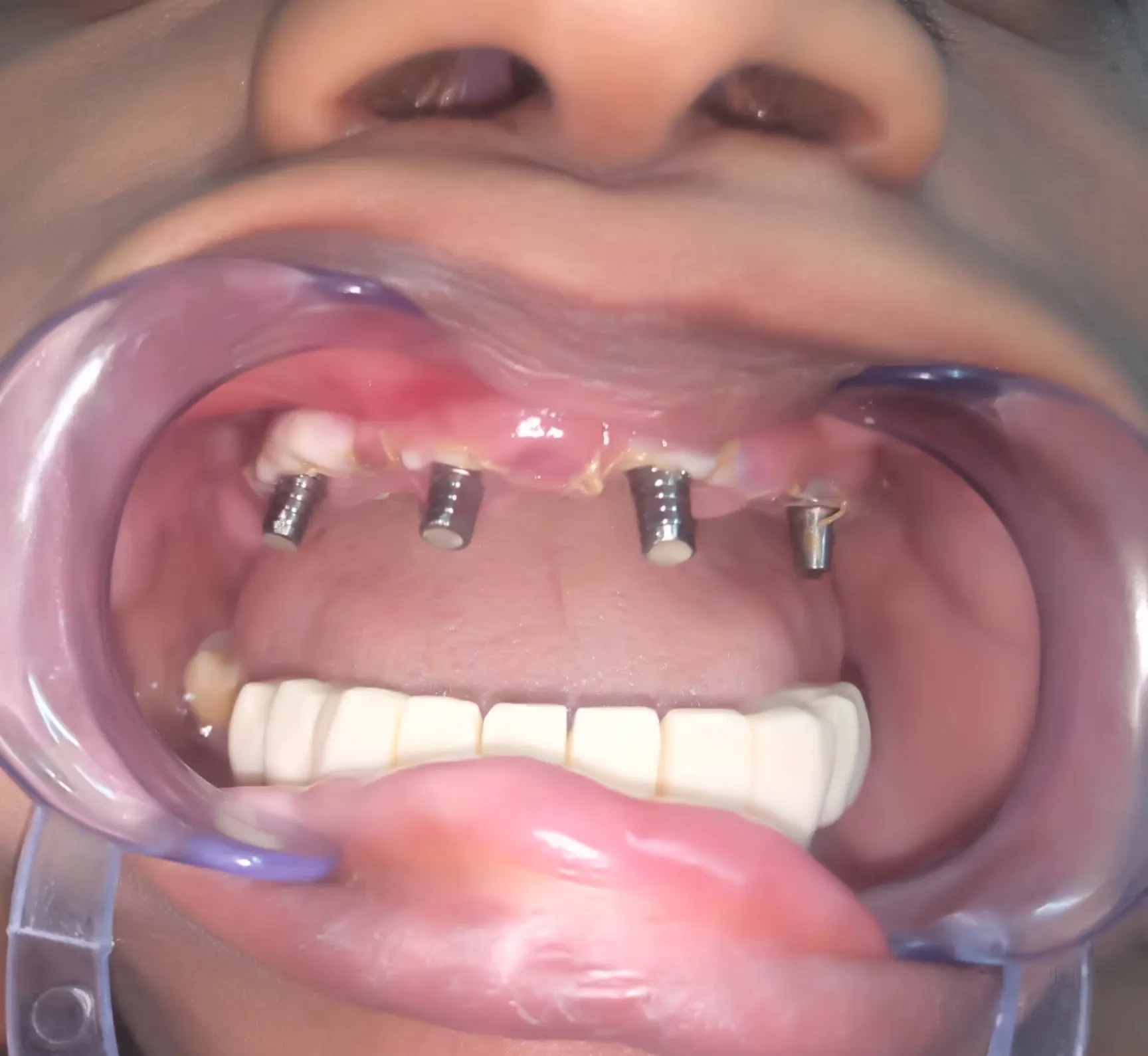 Image of: Kesavan Dental Clinic in K Pudur Madurai 4