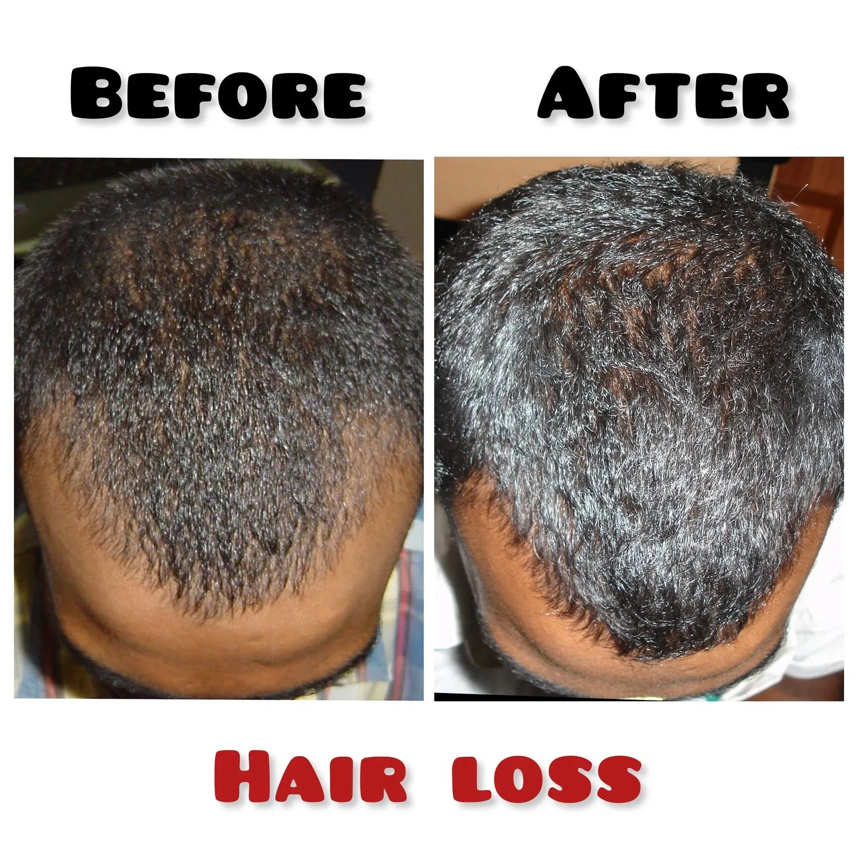 Image of: Madhans Derma Clinic in K Pudur Madurai 7
