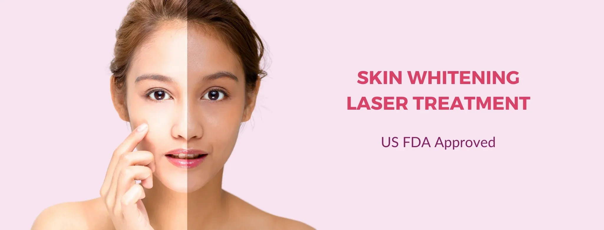 Image of: Sanche Skin and Laser Clinic in K Pudur Maduari 2