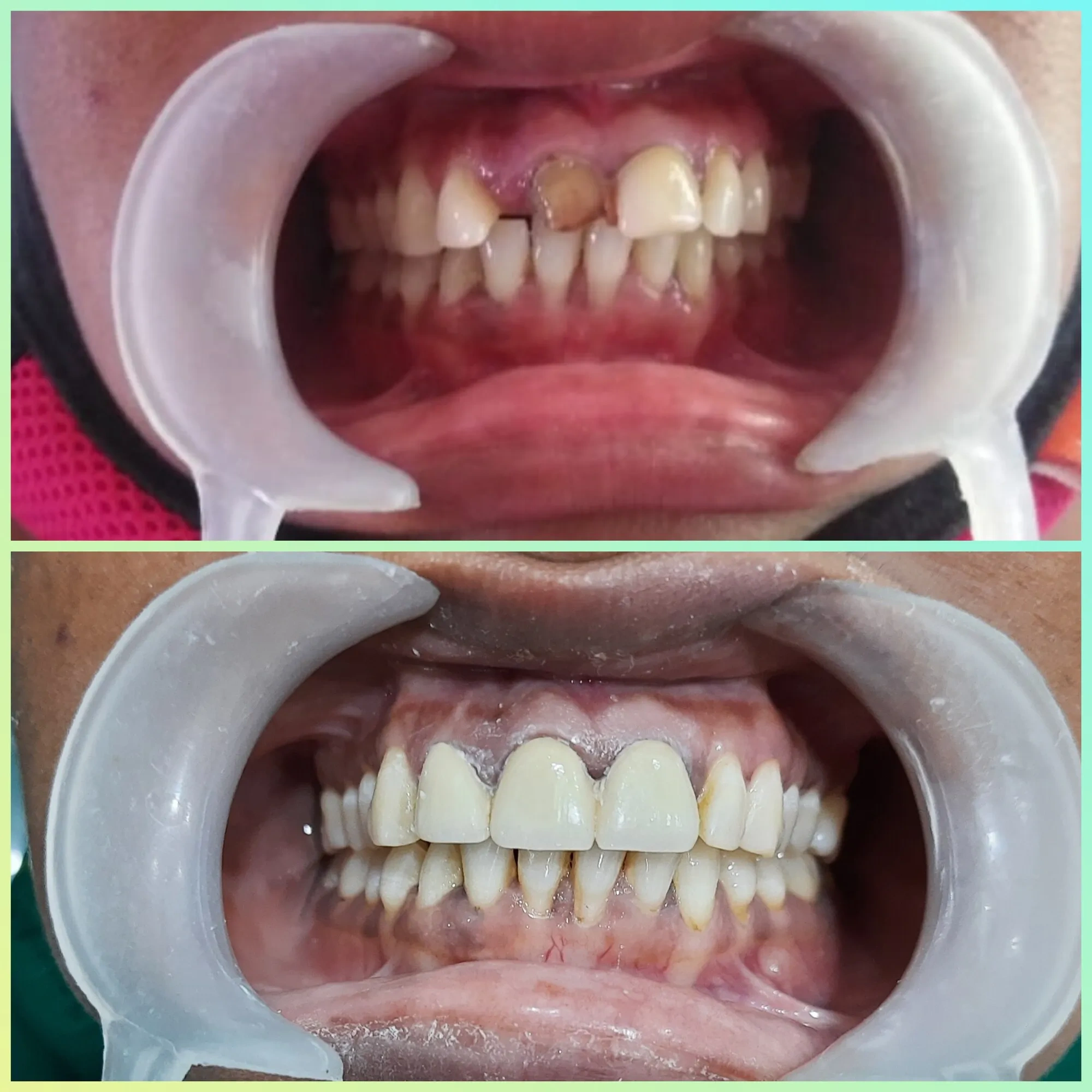 Image of: Shreebooma Dental And Implant Clinic in K Pudur 2