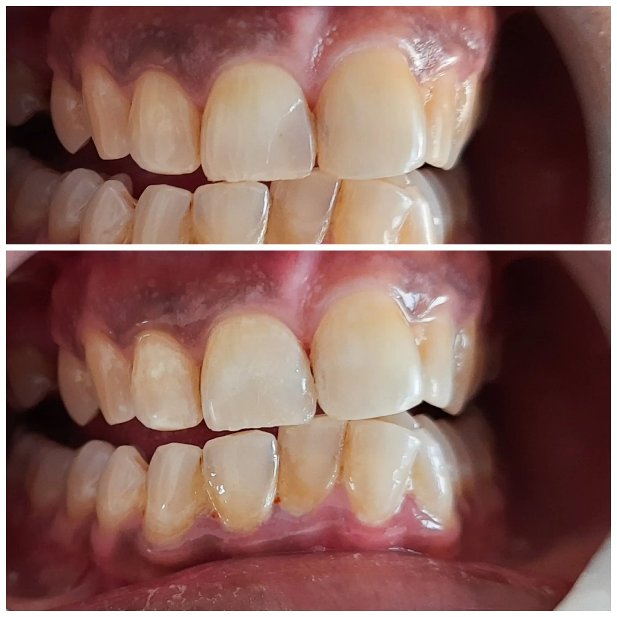 Image of: Shreebooma Dental And Implant Clinic in K Pudur 3