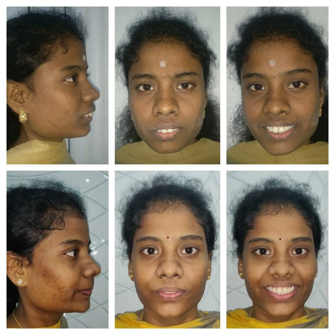Image of: Shreebooma Dental And Implant Clinic in K Pudur 5
