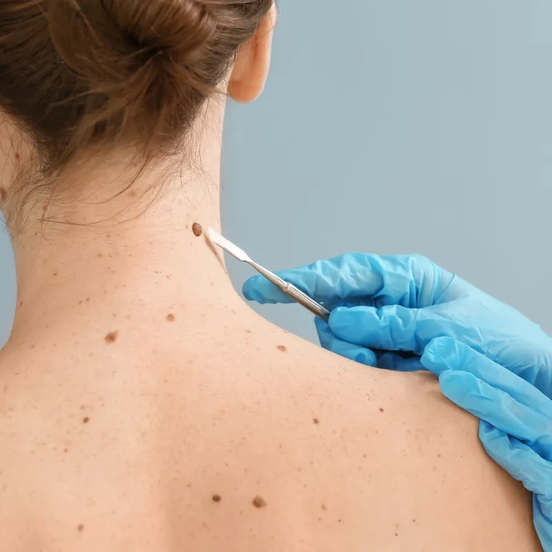Image of: Skin Cosmetic Clinic in K Pudur Madurai 3