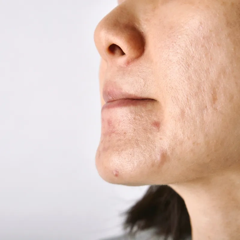 Image of: Skin Cosmetic Clinic in K Pudur Madurai 4
