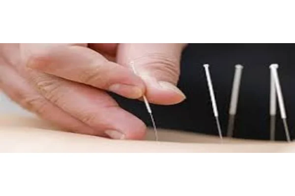 Image of: Malar Acupuncture Clinic in Kadayanallur Tirunelveli