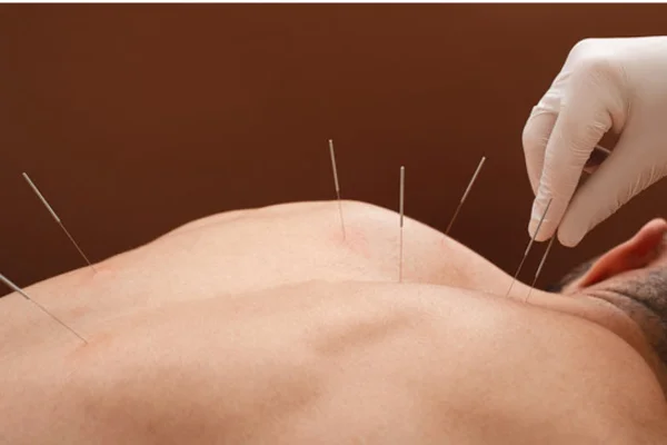 Image of: Afiyat Acupuncture And Homeopathy Physiotherapy in Tirunelveli