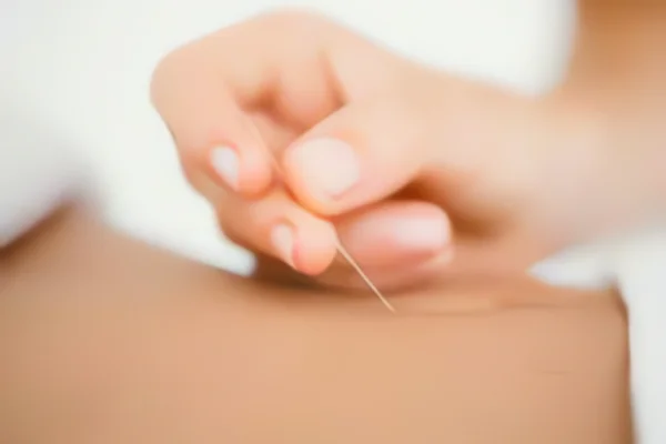 Image of: Mr Radhakrishnan Acupuncture Clinic in Nagercoil