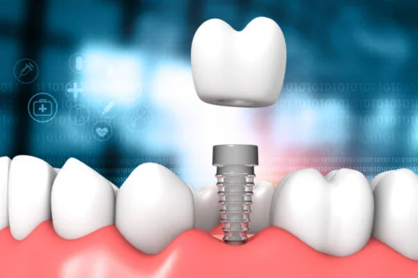 Image of: Dental and Orthodontic Care in Nagercoil