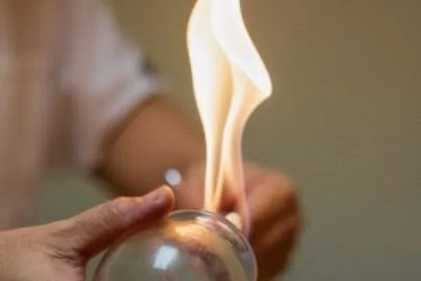 Image of: Prabanjam Acupuncture Clinic Nagercoil Holistic Healing Therapy