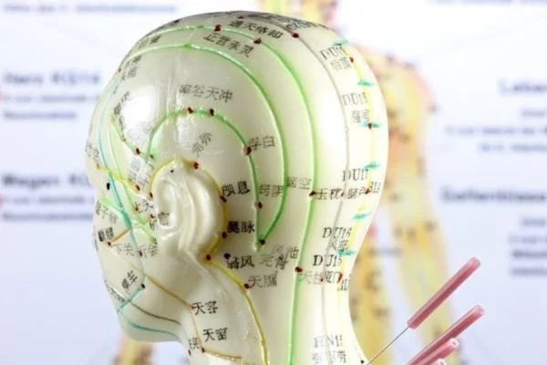 Image of: Gilayath Acupuncture Clinic Holistic Healing Kurusady Nagercoil