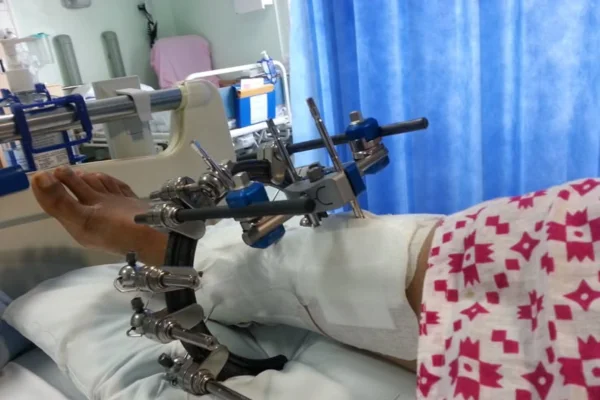 Image of: Poovar Krishnan Orthopaedic Siddha Hospital Mylaudy Treatment