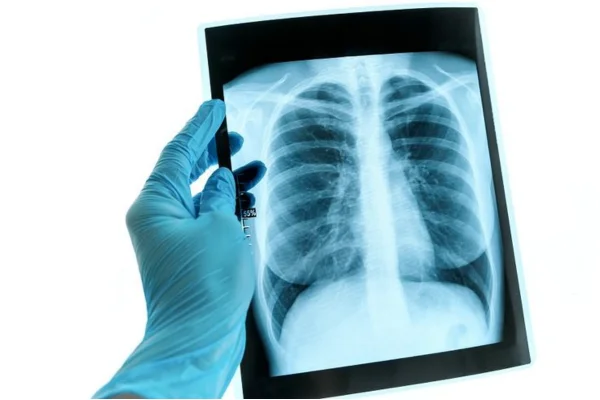 Image of: MMSCANS Diagnostic Centre Eraniel Tamil Nadu