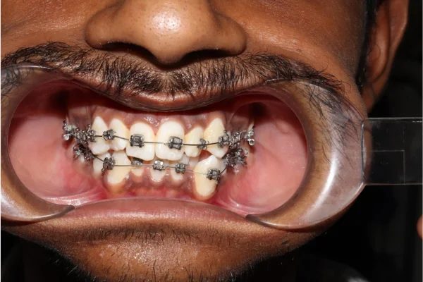 Image of: Raja Dental Clinic Ganapathipuram Rajakkamangalam Tamil Nadu